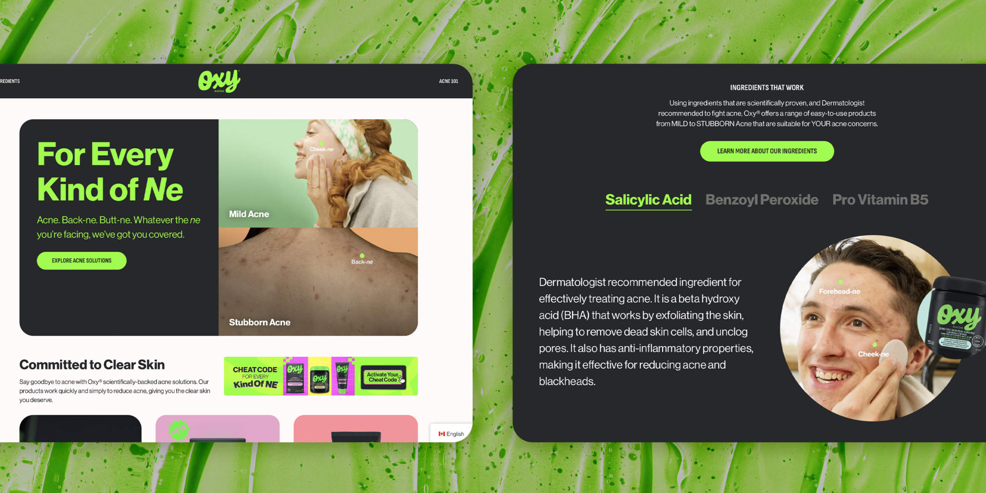 Two graphics of the Oxy Acne Care company website on a green textured background.
